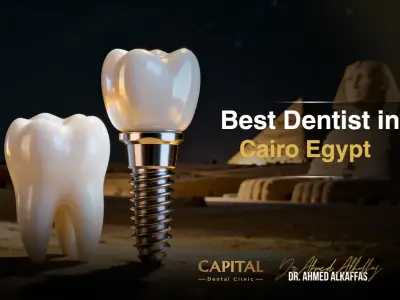 Best dentist in Cairo Egypt
