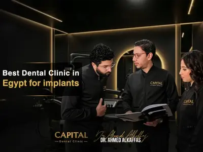 Best Dental Clinic in Egypt for implants (4)